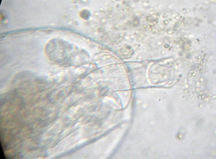 Rotiferi: tentativi di identificazione